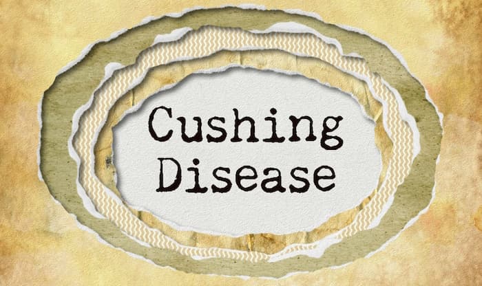 Cushing disease